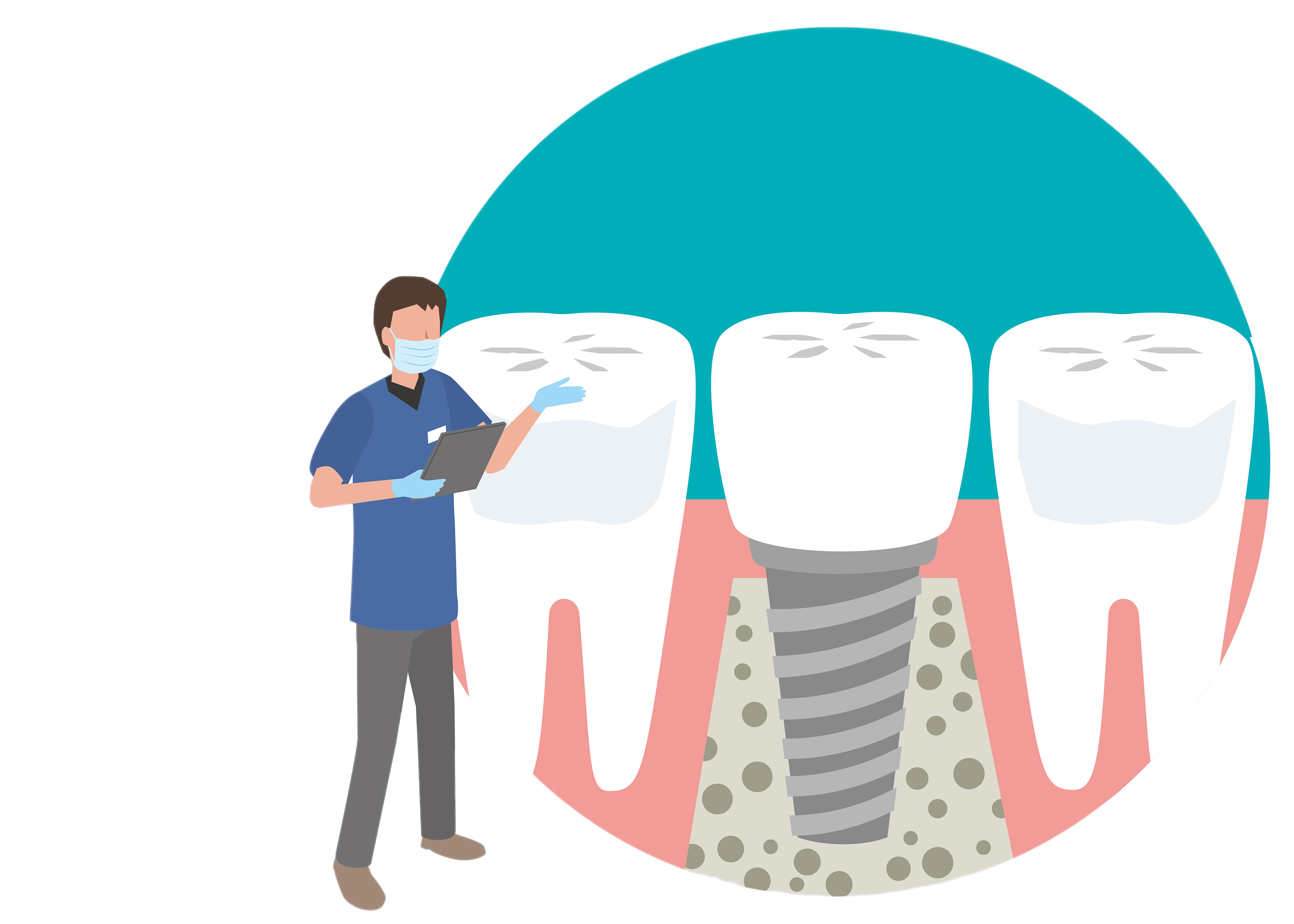 インプラント説明会